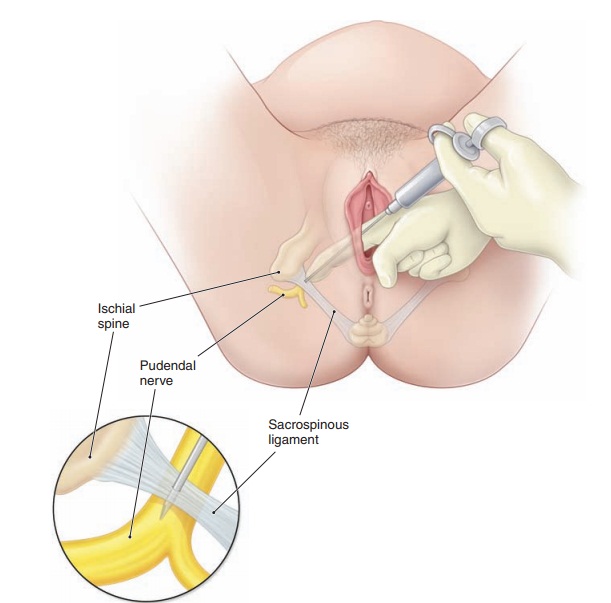 Normal Labor And Delivery General Management