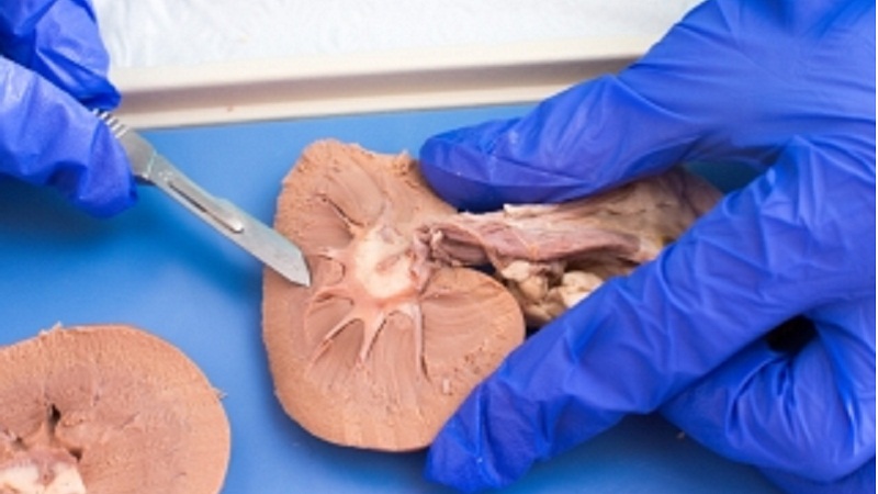 Surgical Pathology Dissection - Lecture Notes, Study Material